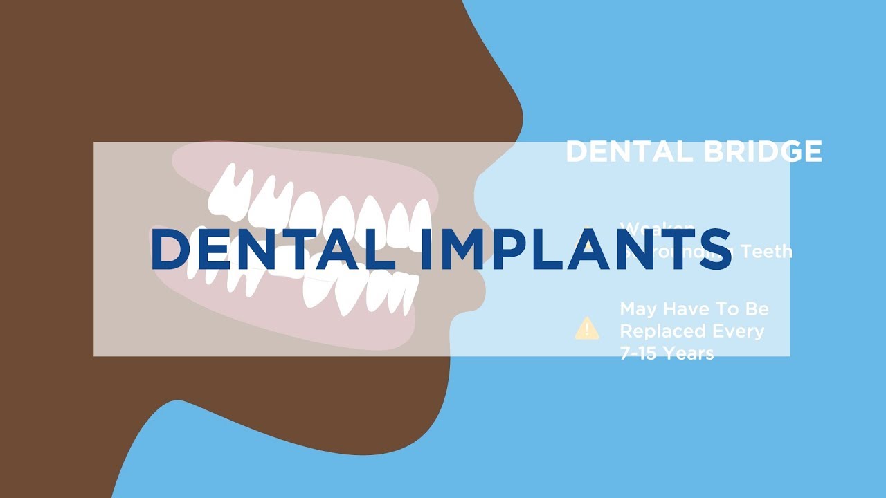 Dental Implants vs. Dentures (:15)